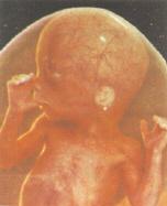 embrion de 17 semanas a 18 semanas de gestacion, 19ª a 20ª semana de embarazo