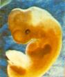 embrion 4ª semana, 6ª semana de embarazo
